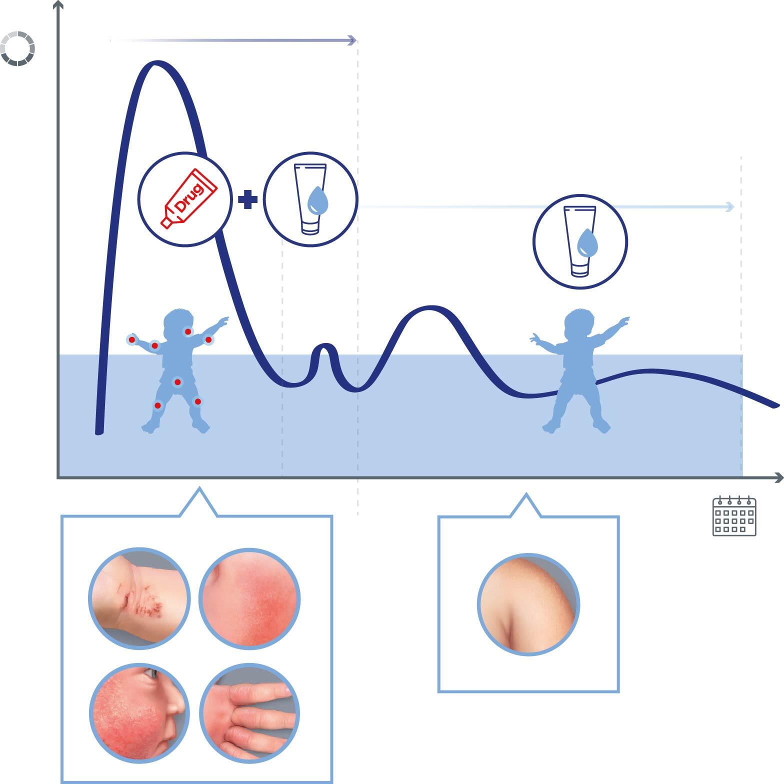 
            md_dexeryl_website-ad-flare-ups-graph
        